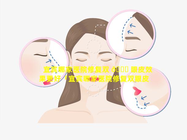 宜宾哪家医院修复双 🐅 眼皮效果更好「宜宾哪家医院修复双眼皮效 🐵 果更好一些」